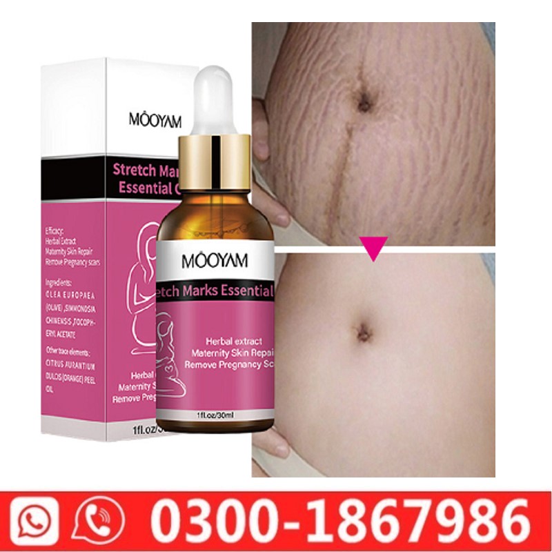 Mooyam Stretch Mark Oil in Pakistan